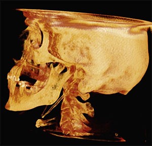 X- Ray of human skull